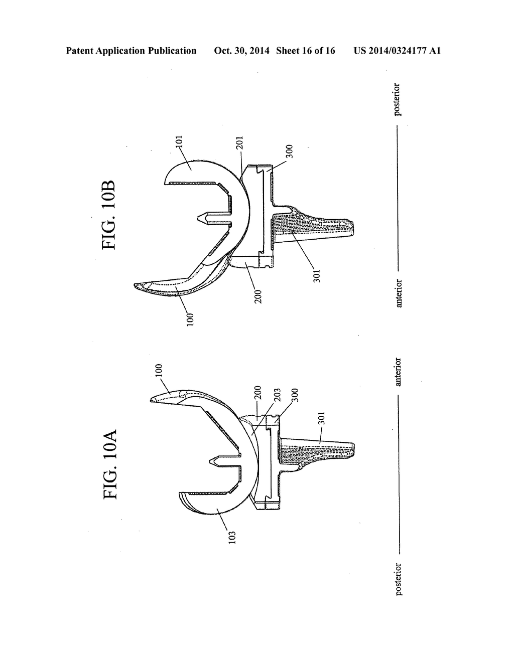 PROSTHETIC JOINT - diagram, schematic, and image 17