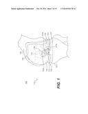 CRUCIATE-RETAINING TIBIAL PROSTHESIS diagram and image