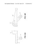 CRUCIATE-RETAINING TIBIAL PROSTHESIS diagram and image