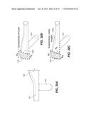 CRUCIATE-RETAINING TIBIAL PROSTHESIS diagram and image