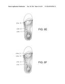 METHODS FOR DESIGNING A FOOT ORTHOTIC diagram and image