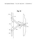 CASEMENT AND AWNING WINDOW OPENING LIMIT DEVICE diagram and image