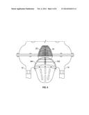 Fuel Turbine and Throttle Box diagram and image