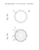 CYCLO REDUCER ARRANGEMENT diagram and image