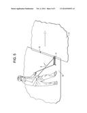 Metal Positioning Device diagram and image