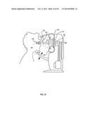 ORTHOVOLTAGE RADIOTHERAPY diagram and image