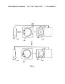 ORTHOVOLTAGE RADIOTHERAPY diagram and image