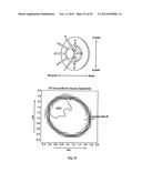 ORTHOVOLTAGE RADIOTHERAPY diagram and image