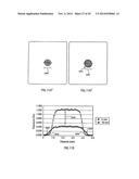 ORTHOVOLTAGE RADIOTHERAPY diagram and image