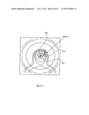 ORTHOVOLTAGE RADIOTHERAPY diagram and image