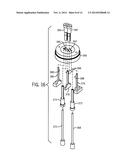 Compression Limiter With Retention Features diagram and image