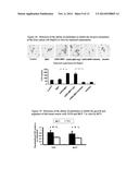 AGR2 BLOCKING ANTIBODY AND USE THEREOF diagram and image