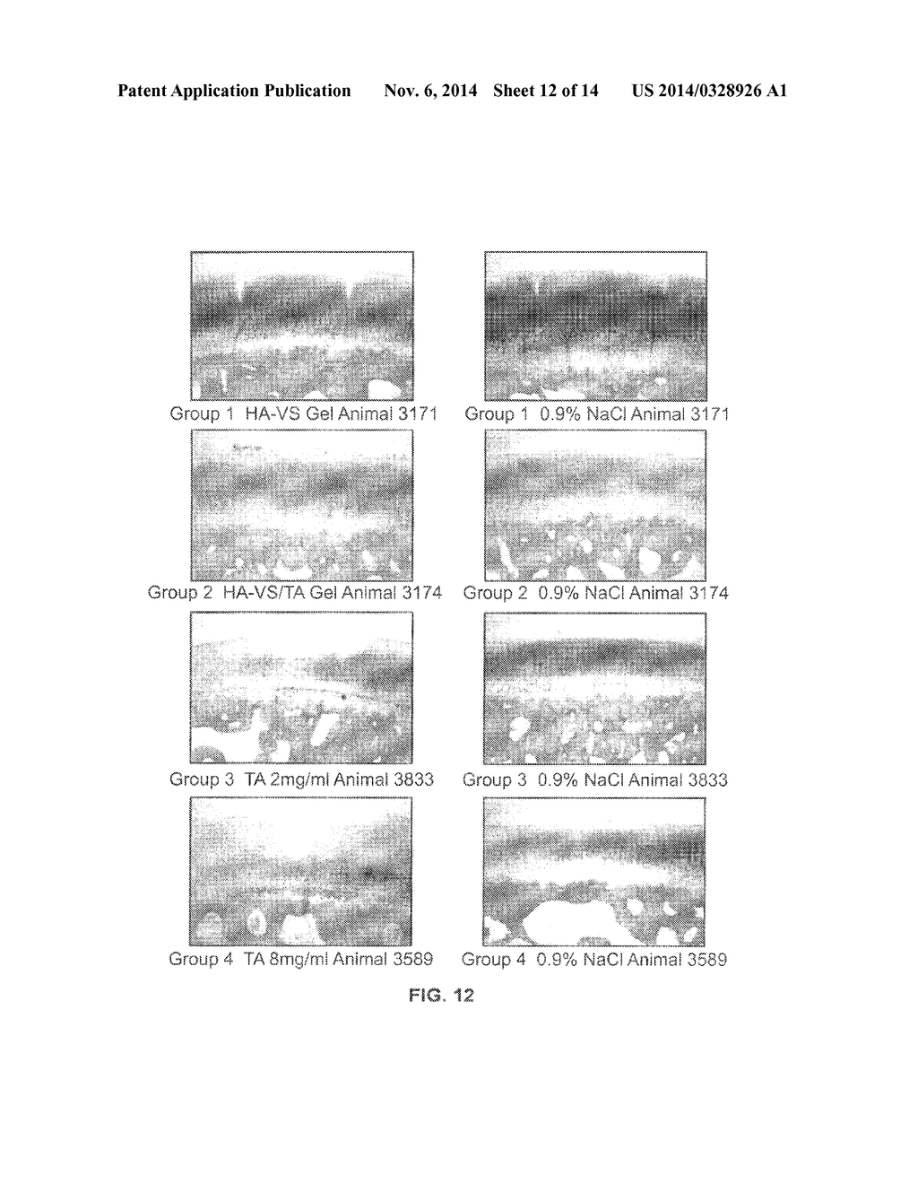 MODIFIED HYALURONIC ACID POLYMER COMPOSITIONS AND RELATED METHODS - diagram, schematic, and image 13