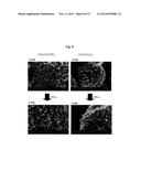 NOVEL SECONDARY STRUCTURE OF CARBON NANOSTRUCTURE, BUNDLE THEREOF AND     COMPOSITE COMPRISING SAME diagram and image