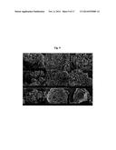 NOVEL SECONDARY STRUCTURE OF CARBON NANOSTRUCTURE, BUNDLE THEREOF AND     COMPOSITE COMPRISING SAME diagram and image