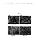 NOVEL SECONDARY STRUCTURE OF CARBON NANOSTRUCTURE, BUNDLE THEREOF AND     COMPOSITE COMPRISING SAME diagram and image