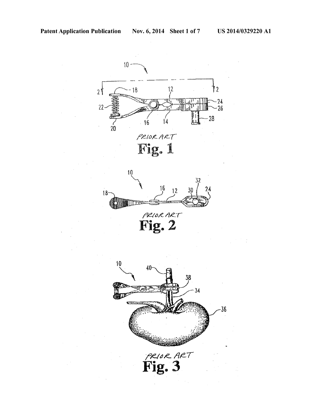 CANNULA WITH FLOATING CLAMPING MEMBER - diagram, schematic, and image 02