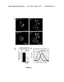 METHODS AND KITS FOR DIAGNOSING AND/OR PROGNOSING OSTEOARTHRITIS diagram and image