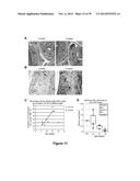 METHODS AND KITS FOR DIAGNOSING AND/OR PROGNOSING OSTEOARTHRITIS diagram and image