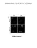 METHODS AND KITS FOR DIAGNOSING AND/OR PROGNOSING OSTEOARTHRITIS diagram and image