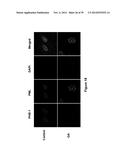 METHODS AND KITS FOR DIAGNOSING AND/OR PROGNOSING OSTEOARTHRITIS diagram and image