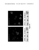 METHODS AND KITS FOR DIAGNOSING AND/OR PROGNOSING OSTEOARTHRITIS diagram and image