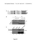 METHODS AND KITS FOR DIAGNOSING AND/OR PROGNOSING OSTEOARTHRITIS diagram and image