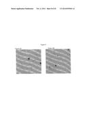 FIBROBLAST GROWTH PATTERNS FOR DIAGNOSIS OF ALZHEIMER S DISEASE diagram and image