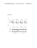 STAT3 ACTIVATION AS A MARKER FOR CLASSIFICATION AND PROGNOSIS OF DLBCL     PATIENTS diagram and image