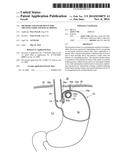 METHODS AND INSTRUMENTS FOR TREATING GERD AND HAITAL HERNIA diagram and image