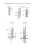 METHODS AND INSTRUMENTS FOR TREATING GERD AND HAITAL HERNIA diagram and image