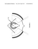 System and Method for Image Guidance During Medical Procedures diagram and image