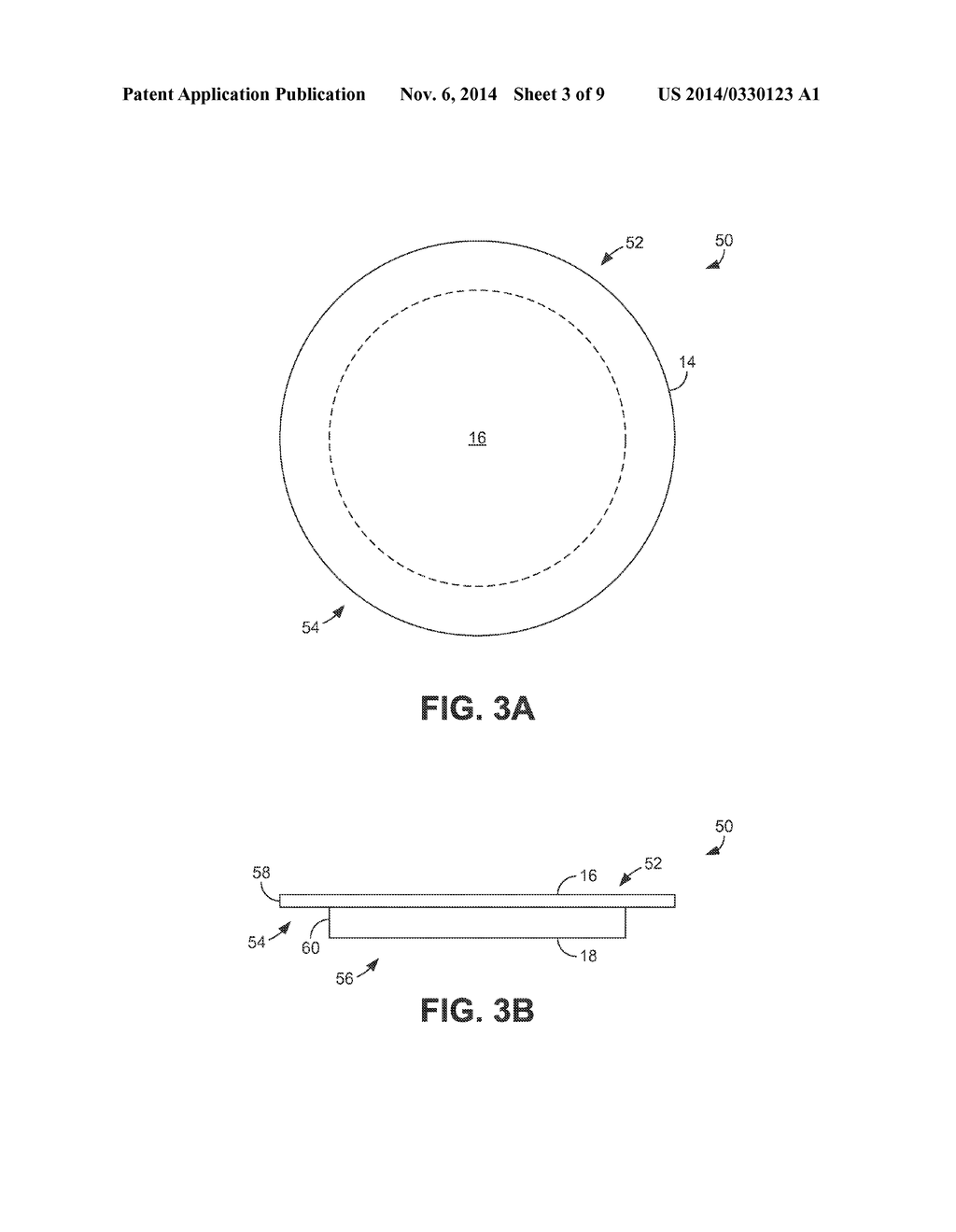 IMPLANTABLE SONIC WINDOWS - diagram, schematic, and image 04