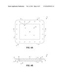 IMPLANTABLE SONIC WINDOWS diagram and image