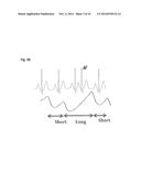 DETECTION AND MONITORING OF ATRIAL FIBRILLATION diagram and image