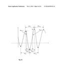 DETECTION AND MONITORING OF ATRIAL FIBRILLATION diagram and image