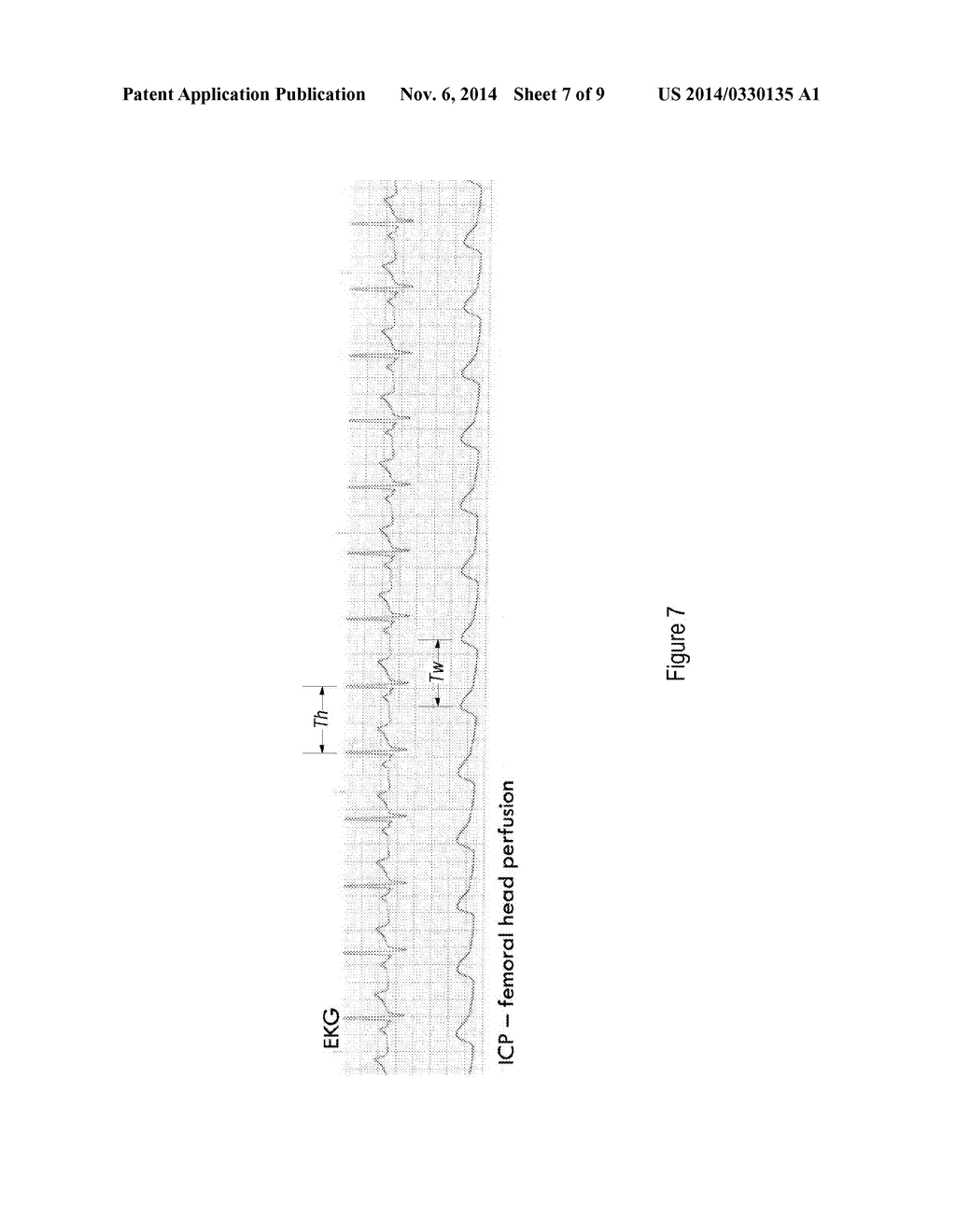 CANNULATED SCREW PROBE - diagram, schematic, and image 08