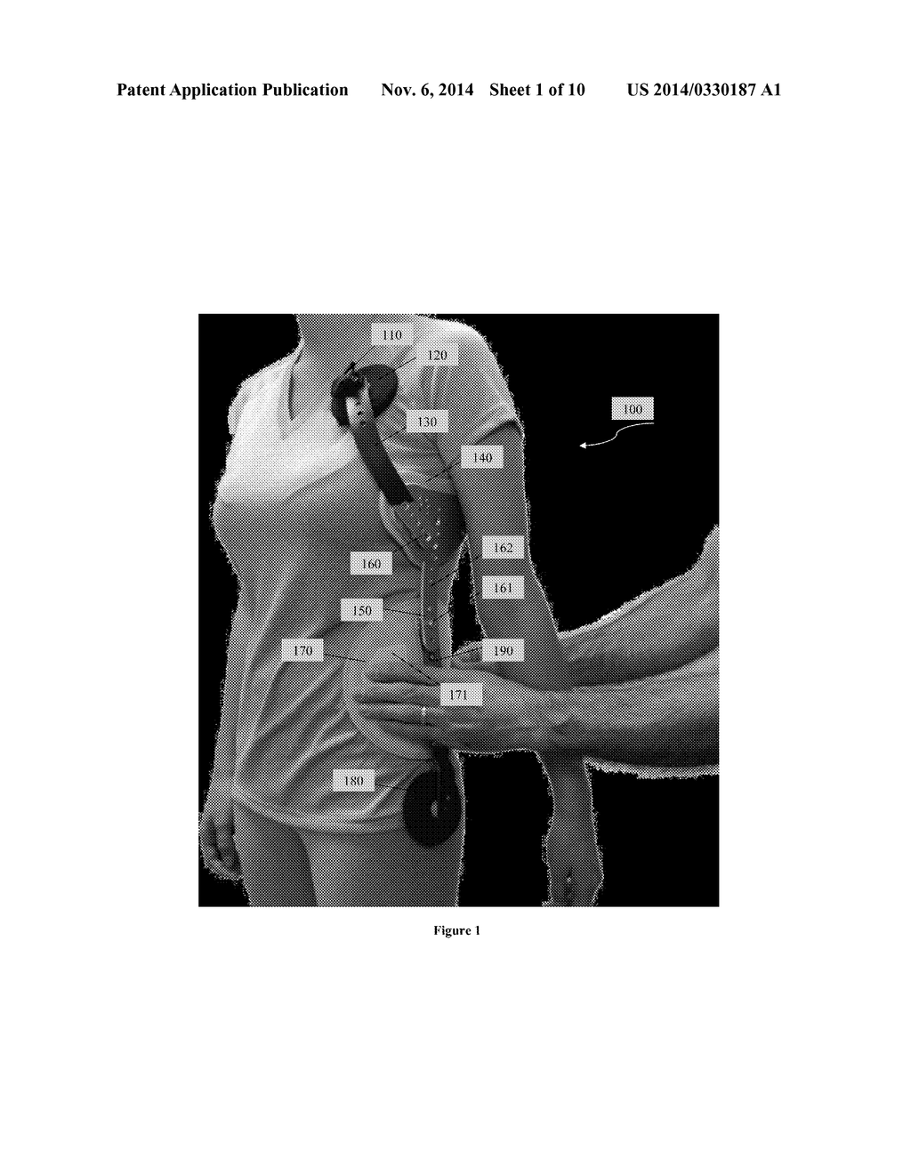 Scoliosis Brace - diagram, schematic, and image 02