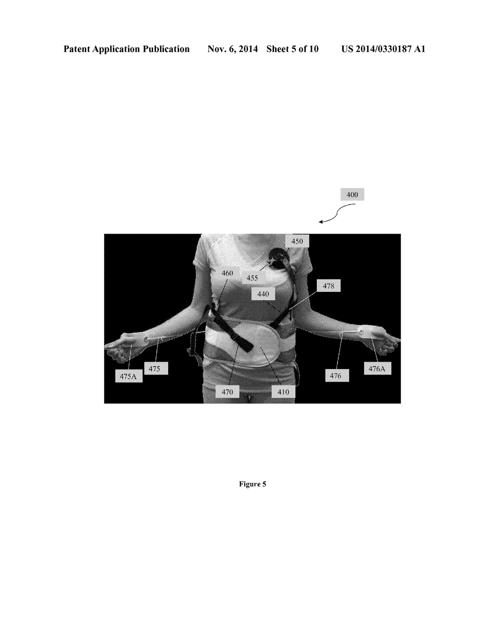 Scoliosis Brace - diagram, schematic, and image 06