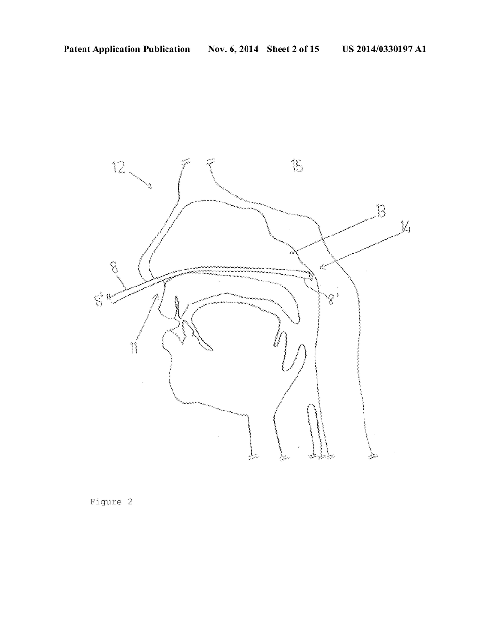 Device and Method for Cooling a Patient - diagram, schematic, and image 03