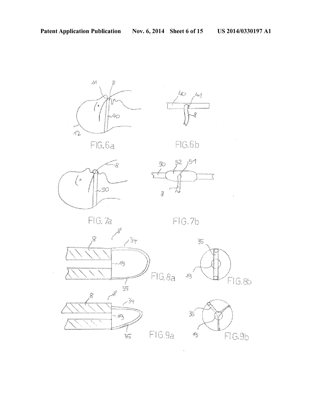 Device and Method for Cooling a Patient - diagram, schematic, and image 07