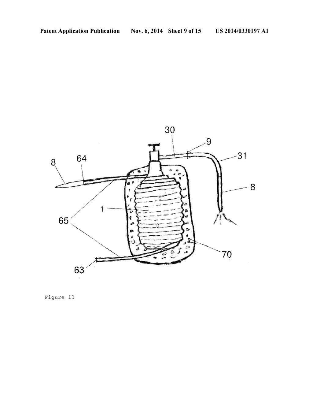 Device and Method for Cooling a Patient - diagram, schematic, and image 10