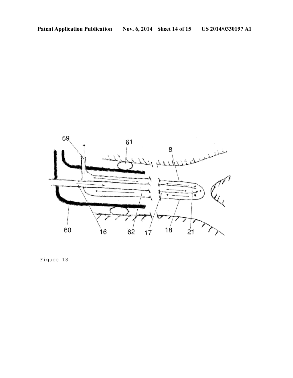 Device and Method for Cooling a Patient - diagram, schematic, and image 15