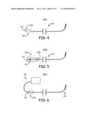 SYSTEMS AND METHODS FOR IMPLANTING A MEDICAL ELECTRICAL LEAD diagram and image