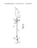 SYSTEMS AND METHODS FOR IMPLANTING A MEDICAL ELECTRICAL LEAD diagram and image