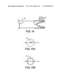 SYSTEMS AND METHODS FOR IMPLANTING A MEDICAL ELECTRICAL LEAD diagram and image