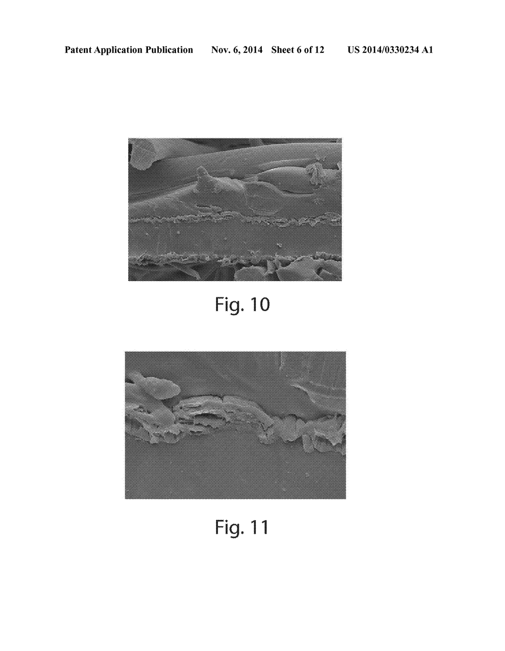 ABSORBENT ARTICLES COMPRISING STRETCH LAMINATES - diagram, schematic, and image 07