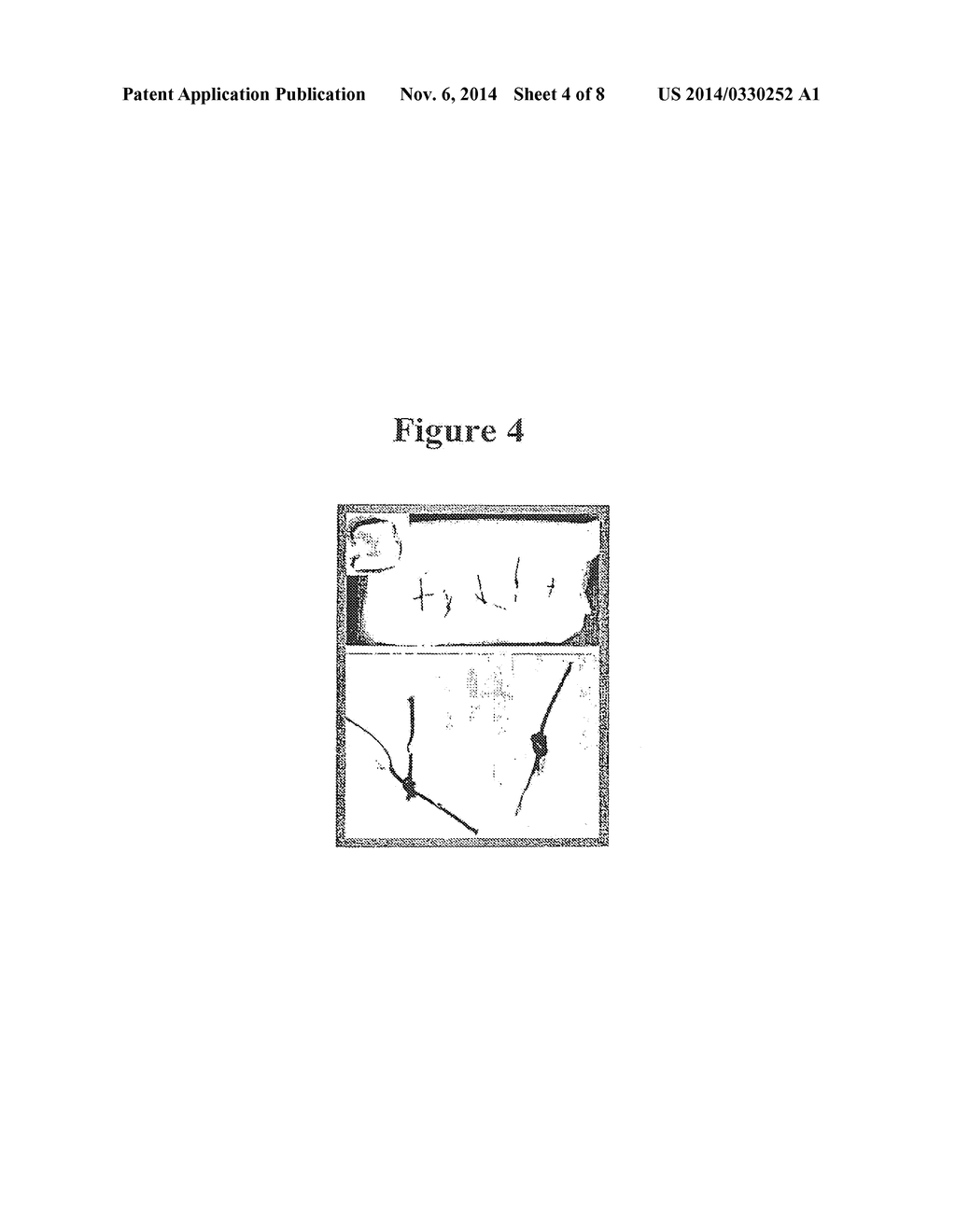 BIOMATRIX STRUCTURAL CONTAINMENT AND FIXATION SYSTEMS AND METHODS OF USE     THEREOF - diagram, schematic, and image 05