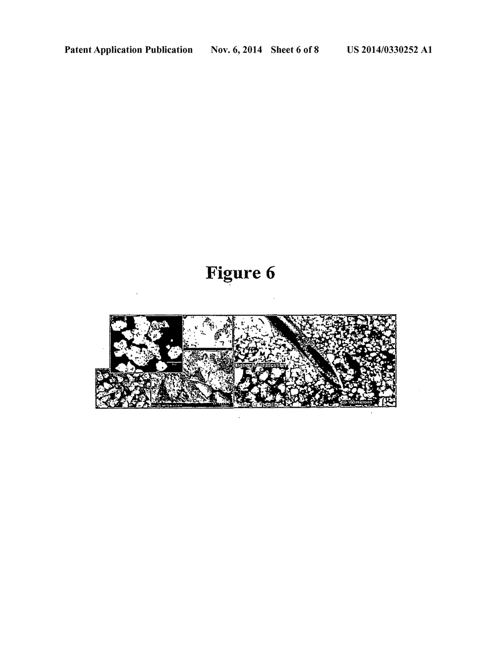 BIOMATRIX STRUCTURAL CONTAINMENT AND FIXATION SYSTEMS AND METHODS OF USE     THEREOF - diagram, schematic, and image 07