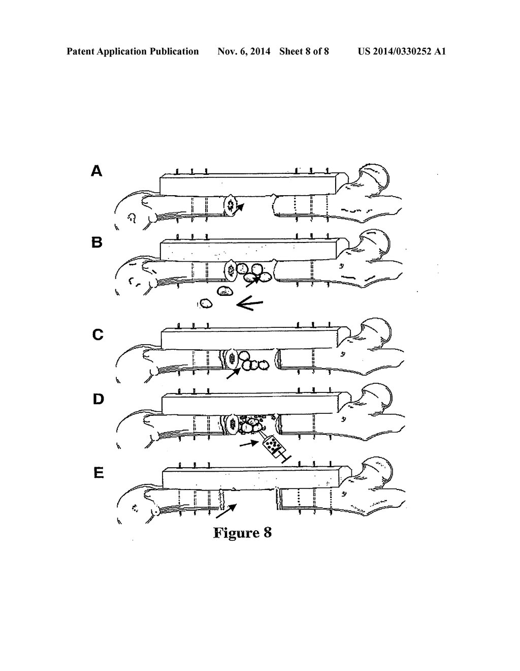 BIOMATRIX STRUCTURAL CONTAINMENT AND FIXATION SYSTEMS AND METHODS OF USE     THEREOF - diagram, schematic, and image 09